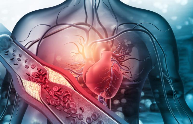 Cardiovascular