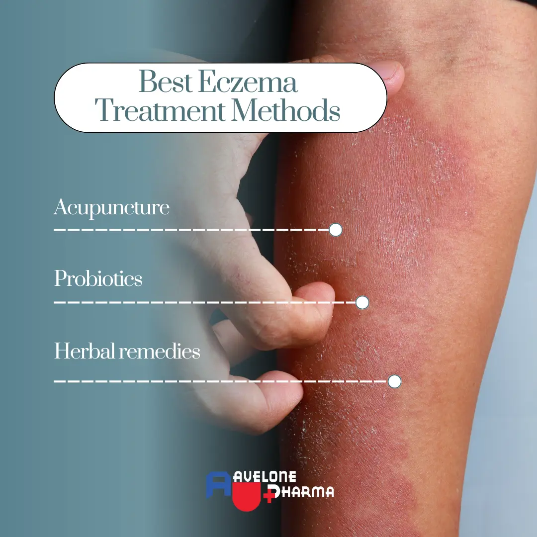 alternative eczema treatments 